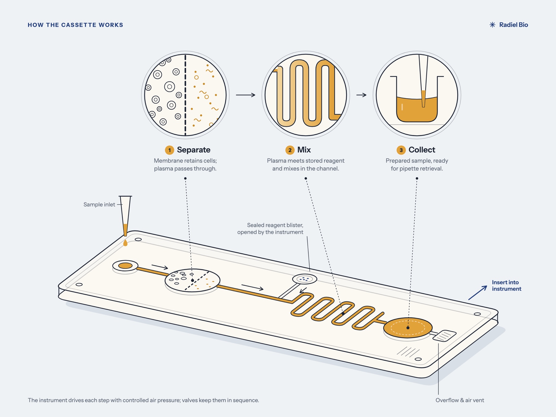 Technical illustration of the cassette in three steps: separate, mix and collect
