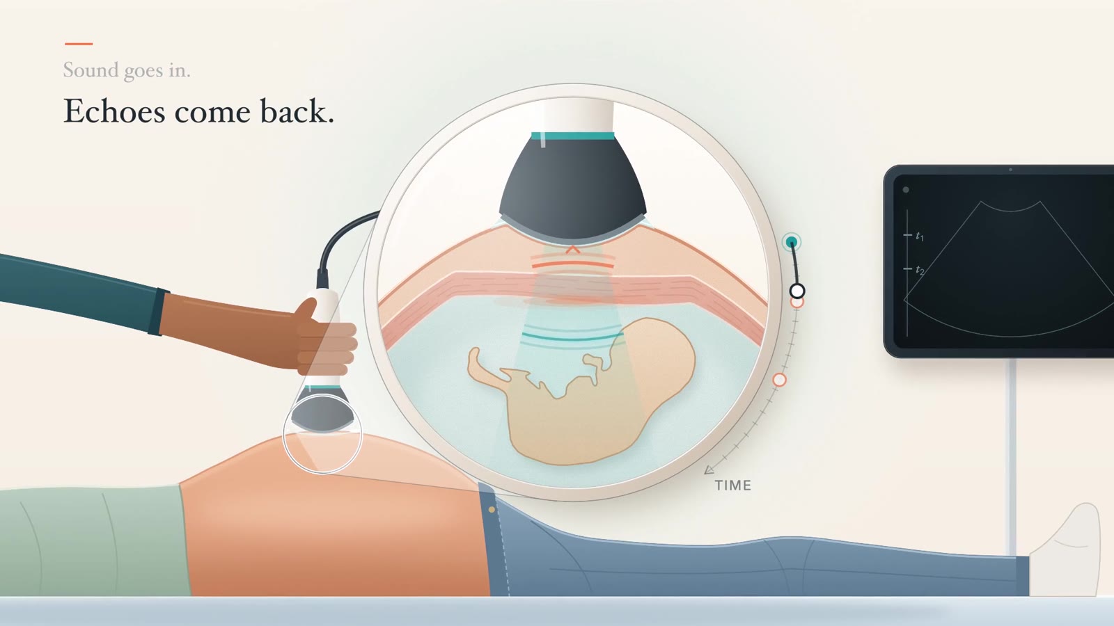 Still from an illustrated animation explaining how ultrasound works